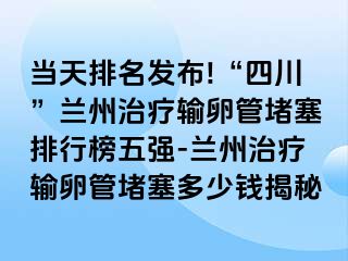 当天排名发布!“四川”兰州治疗输卵管堵塞排行榜五强-兰州治疗输卵管堵塞多少钱揭秘